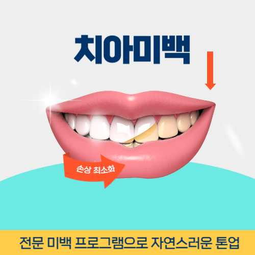 용인치과 용인시 치과 치아미백