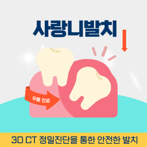 용인치과 용인시 치과 사랑니 발치