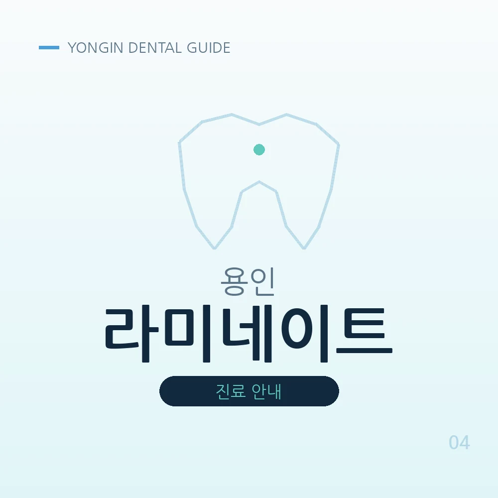 용인라미네이트
